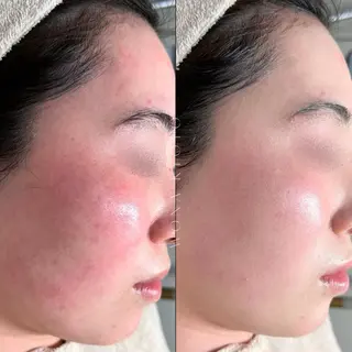 WONA所属・Yamada Rのエステ・リラクイメージ