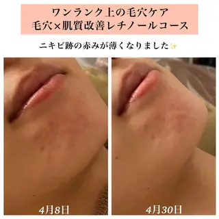 Bellesthe （ベルエステ）のエステ・リラクイメージ