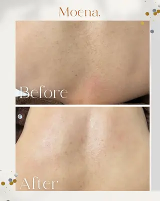 Moena.所属・Moena. 武蔵小杉🫧のエステ・リラクイメージ