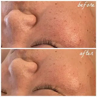 メンズ メナード岐阜市茜部 杉浦のエステ・リラクイメージ