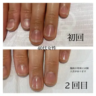 ネイル 自爪育成専門サロン エムロードゥ池下のネイルデザイン