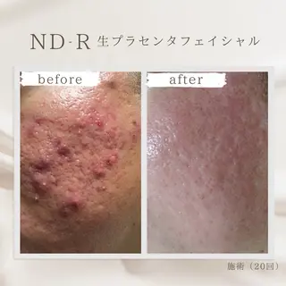 Charm ✿suzuのエステ・リラクイメージ