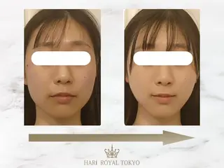 ハリロイヤルトーキョー武蔵小山所属・ニューハーフ鍼灸師 🖤🤍Saya🌹のエステ・リラクイメージ