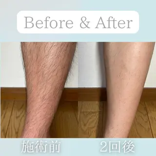 美肌脱毛&毛穴専門 Nico🐰ྀི♡のエステ・リラクイメージ