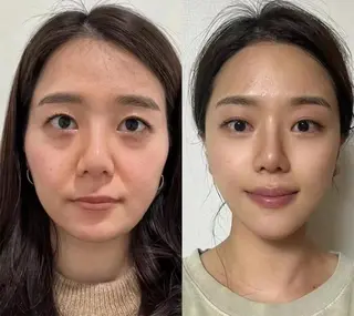 ネイル aliaハイフ&水光ジェットサロン所属・aliaハーブ水光店 エステティシャン募集のエステ・リラクイメージ