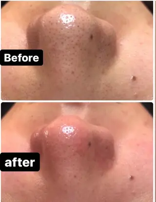 美顔秘密基地新宮所属・美顔秘密基地 新宮のその他イメージ