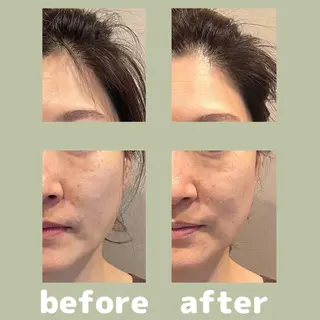 美容鍼灸サロン      APLUS所属・美容鍼灸サロン APLUSのエステ・リラクイメージ