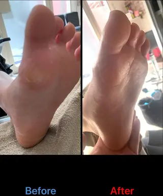 ネイル 毛穴改善/脱毛 ネイル　川上久仁子のエステ・リラクイメージ