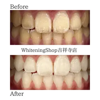 ホワイトニングショッ 吉祥寺2号店のエステ・リラクイメージ