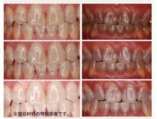 Rei to youのマツエク・マツパデザイン