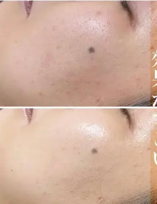 ☺ハーブピール💕 ソフィアカロン💖のエステ・リラクイメージ