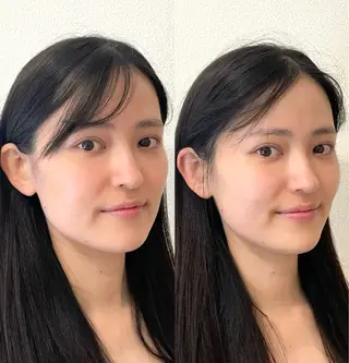 小顔/たるみ/黒ずみ除去専門サロン/SONA 大和西大寺店所属・【小顔専門看護師 サロンSONA】のエステ・リラクイメージ