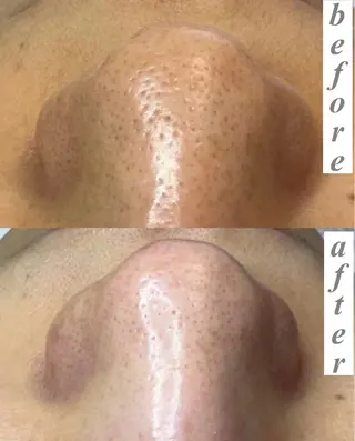 毛穴専門サロン ライカブルーのエステ・リラクイメージ