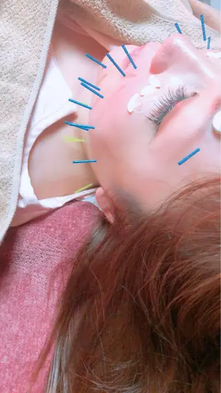 美容鍼灸女性専用 りんご鍼灸治療院のエステ・リラクイメージ