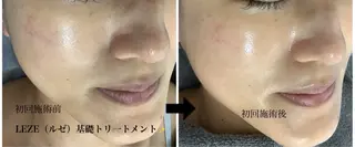 🩵Tatsumi Kana🩵のエステ・リラクイメージ