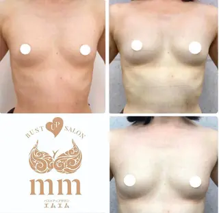 バストアップサロンmm【エムエム】所属・バストアップサロン mm【エムエム】のエステ・リラクイメージ