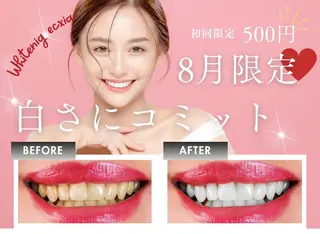 セルフホワイトニング エクシア沖縄宮里店のその他イメージ