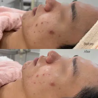 メンズ 〈etre〉トータルビューティーサロン所属・etre - 韓国肌管理 -のエステ・リラクイメージ