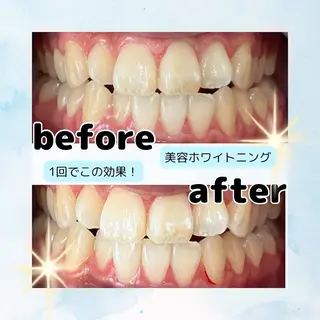 ホワイトニングサロン Soleilのその他イメージ