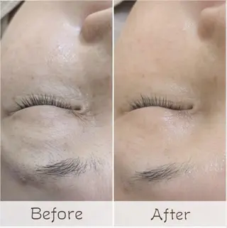 フェイシャル/毛穴 /シミ/たるみ東灘区のエステ・リラクイメージ