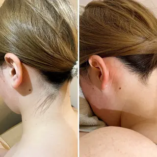 うなじ脱毛/美肌脱毛 LABELのエステ・リラクイメージ