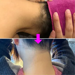 脱毛＆エステサロン【アンリミット】所属・森谷 莉美のエステ・リラクイメージ