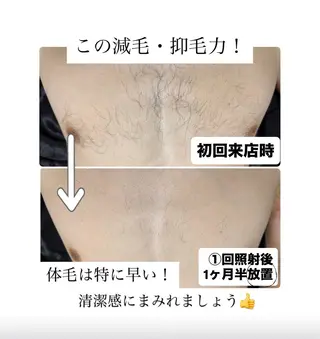 メンズ メンズ脱毛サロン Le falcoのエステ・リラクイメージ