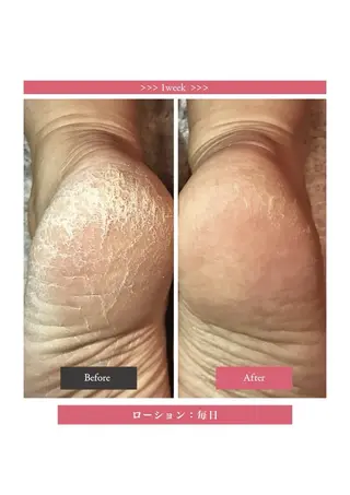 nouvelle  plume所属・ヌーベル プリュムのエステ・リラクイメージ