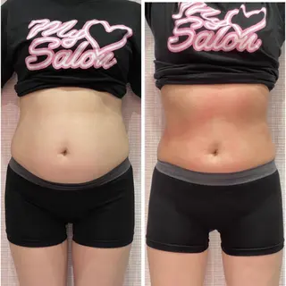 定額制セルフエステ my　salonのエステ・リラクイメージ