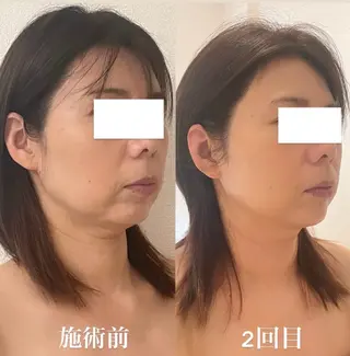 小顔/たるみ/黒ずみ除去専門サロン/SONA 大和西大寺店所属・【小顔専門看護師 サロンSONA】のエステ・リラクイメージ