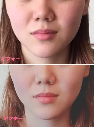 小顔サロン ソ.ルシエのエステ・リラクイメージ