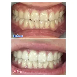 MBEAUTYSALON 千葉店・京成大久保所属・Melty 輝のその他イメージ