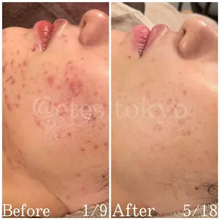 etes （エトエス）所属・etes.tokyo 中目黒のエステ・リラクイメージ