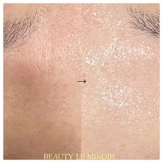 ビューティー ミロワールのエステ・リラクイメージ