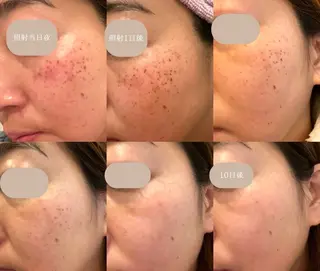 小顔/たるみ/黒ずみ除去専門サロン/SONA 大和西大寺店所属・【小顔専門看護師 サロンSONA】のエステ・リラクイメージ