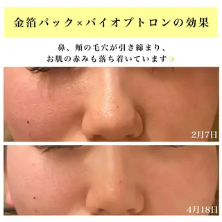 Bellesthe (ベルエステ)のエステ・リラクイメージ