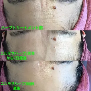 氣楽所属・松下 さゆりのエステ・リラクイメージ