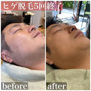 HAIRS YOSHIOKA所属・ヘアーズヨシオカ MENSヒゲ脱毛のエステ・リラクイメージ