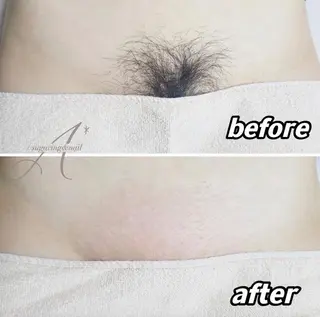 【A*エースター】 KARINのエステ・リラクイメージ