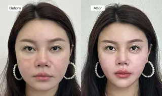 愛維美水光美肌専門店所属・愛維美水光美肌専門店 メンズレディースokのエステ・リラクイメージ