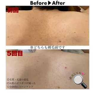 美容脱毛専門店 Lé pia レピアのエステ・リラクイメージ