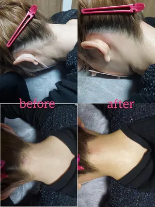 脱毛サロンLULA 恵比寿店濱野のエステ・リラクイメージ