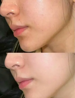 アイブロウ 愛維美水光美肌専門店所属・愛維美水光美肌専門店 メンズレディースokのエステ・リラクイメージ