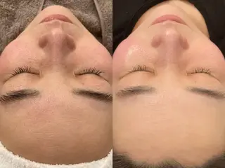 OPREA 栄店のエステ・リラクイメージ