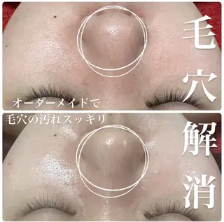 ニキビ毛穴専門店Beautysalon Luana所属・小林 まいのエステ・リラクイメージ