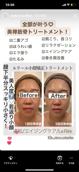 プライベートサロンLe Rire【ルリール】所属・美肌•小顔サロン ルリールのエステ・リラクイメージ