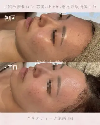 芯美-shinbi-所属・EMI/恵比寿/ 肌荒れ改善サロンのエステ・リラクイメージ
