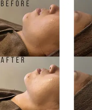 骨気&Relaxation vivian所属・VIVIAN 前田のエステ・リラクイメージ