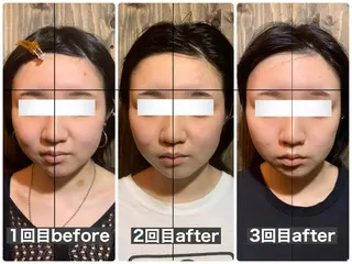 💎後悔させない小顔 矯正💎イトヤマ🌱のエステ・リラクイメージ