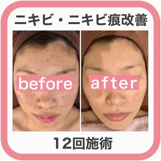 ミディアム カラー パーマ ヘアアレンジ メンズ キッズ ネイル マツエク・マツパ ニキビ・肌質改善専門 ♡人生が変わるサロンのエステ・リラクイメージ